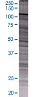 SDS-PAGE - KDS overexpression 293T lysate (whole cell) (AB94147), expandable thumbnail