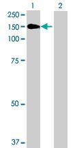 Western blot - KDS overexpression 293T lysate (whole cell) (AB94147), expandable thumbnail
