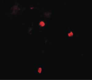 Immunocytochemistry/ Immunofluorescence - Anti-Keap1 antibody (AB139729)