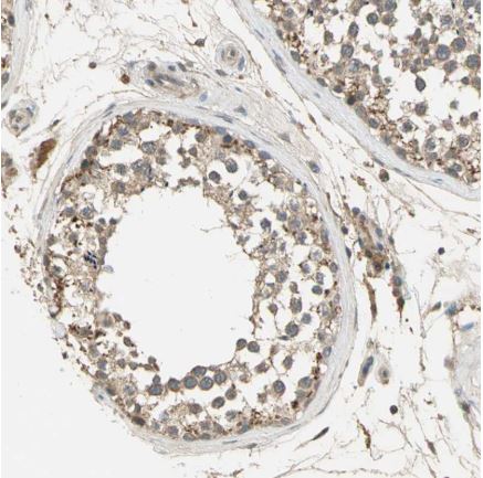 Immunohistochemistry (Formalin/PFA-fixed paraffin-embedded sections) - Anti-Keap1 antibody (AB218815), expandable thumbnail