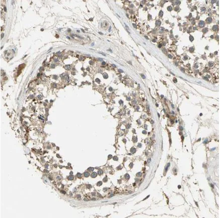 Immunohistochemistry (Formalin/PFA-fixed paraffin-embedded sections) - Anti-Keap1 antibody (AB218815)