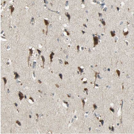 Immunohistochemistry (Formalin/PFA-fixed paraffin-embedded sections) - Anti-Keap1 antibody (AB218815), expandable thumbnail