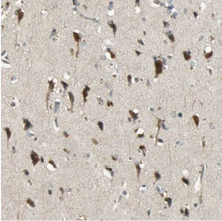 Immunohistochemistry (Formalin/PFA-fixed paraffin-embedded sections) - Anti-Keap1 antibody (AB218815)