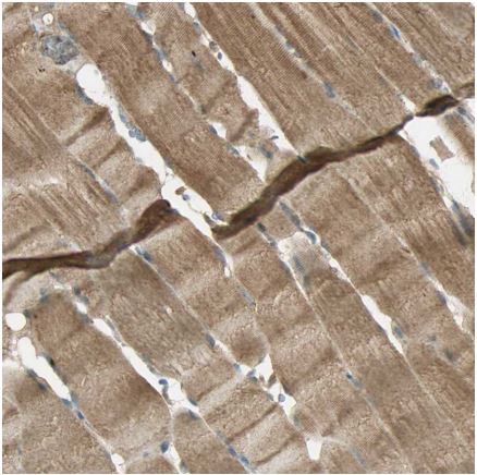 Immunohistochemistry (Formalin/PFA-fixed paraffin-embedded sections) - Anti-Keap1 antibody (AB218815), expandable thumbnail