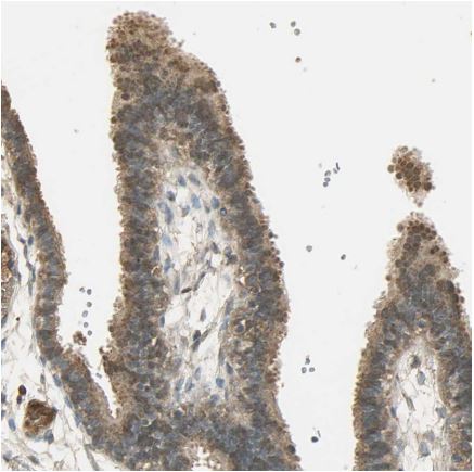 Immunohistochemistry (Formalin/PFA-fixed paraffin-embedded sections) - Anti-Keap1 antibody (AB218815), expandable thumbnail