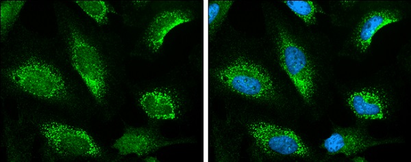Immunocytochemistry/ Immunofluorescence - Anti-Keap1 antibody (AB226997), expandable thumbnail