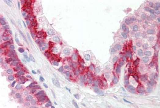 Immunohistochemistry (Formalin/PFA-fixed paraffin-embedded sections) - Anti-Keap1 antibody - C-terminal (AB189952), expandable thumbnail