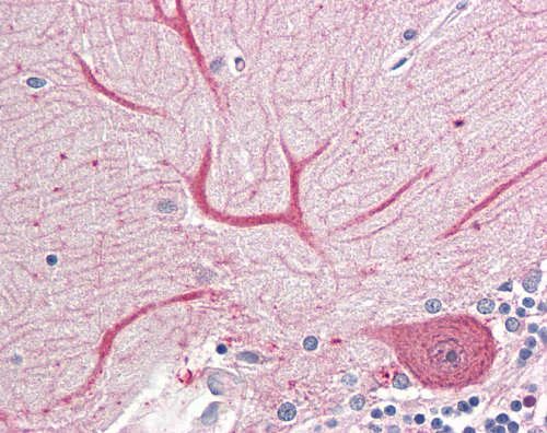 Immunohistochemistry (Formalin/PFA-fixed paraffin-embedded sections) - Anti-Keap1 antibody - N-terminal (AB166721)