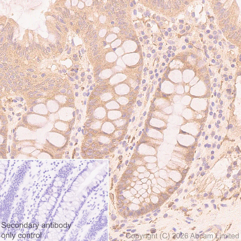 Immunohistochemistry (Formalin/PFA-fixed paraffin-embedded sections) - Anti-Kelch-like ECH-associated protein 1 antibody [EPR31136-529] (AB326338)