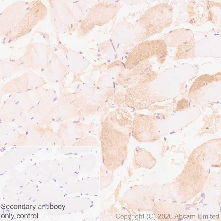 Immunohistochemistry (Formalin/PFA-fixed paraffin-embedded sections) - Anti-Kelch-like ECH-associated protein 1 antibody [EPR31136-529] (AB326338)