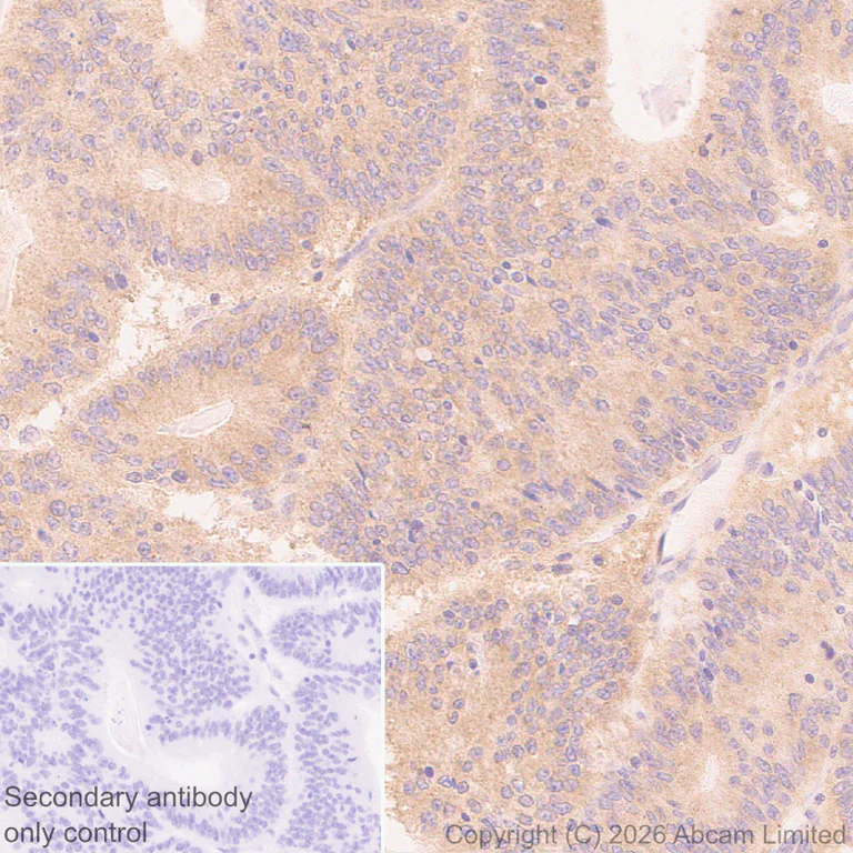 Immunohistochemistry (Formalin/PFA-fixed paraffin-embedded sections) - Anti-Kelch-like ECH-associated protein 1 antibody [EPR31136-529] (AB326338)