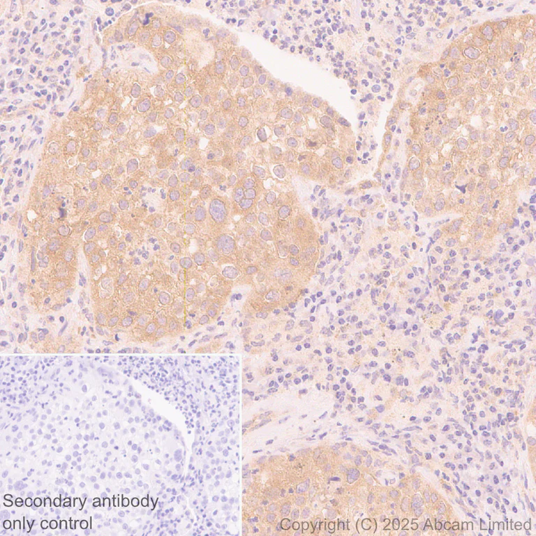 Immunohistochemistry (Formalin/PFA-fixed paraffin-embedded sections) - Anti-Kelch-like ECH-associated protein 1 antibody [EPR31136-529] (AB326338)