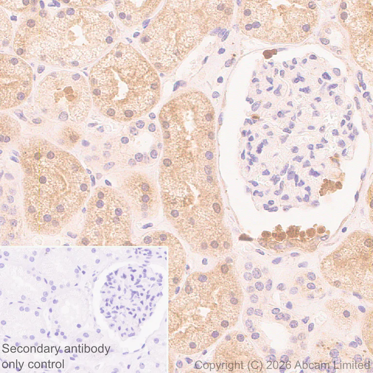 Immunohistochemistry (Formalin/PFA-fixed paraffin-embedded sections) - Anti-Kelch-like ECH-associated protein 1 antibody [EPR31136-529] - BSA and Azide free (AB326341)