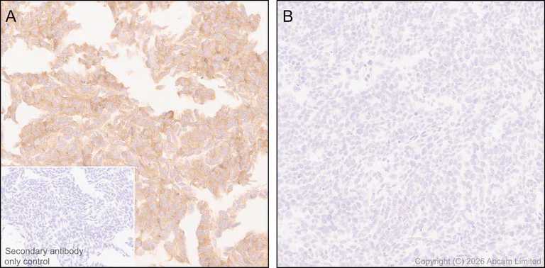 Immunohistochemistry (Formalin/PFA-fixed paraffin-embedded sections) - Anti-Kelch-like ECH-associated protein 1 antibody [EPR31136-529] - BSA and Azide free (AB326341)