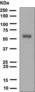 Western blot - Anti-Keratin 12/K12 antibody [EPR1609(2)] (AB124975)