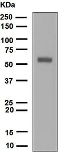 Western blot - Anti-Keratin 12/K12 antibody [EPR1609(2)] - BSA and Azide free (AB248082)