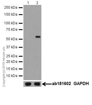 Western blot - Anti-Keratin 12/K12 antibody [EPR17882] (AB185627)