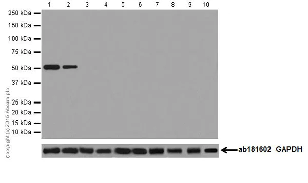 Western blot - Anti-Keratin 12/K12 antibody [EPR17882] (AB185627)