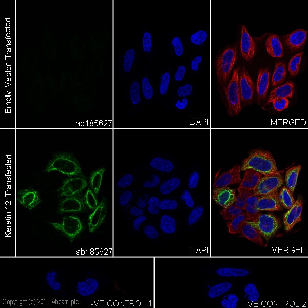 Immunocytochemistry/ Immunofluorescence - Anti-Keratin 12/K12 antibody [EPR17882] - BSA and Azide free (AB240295), expandable thumbnail