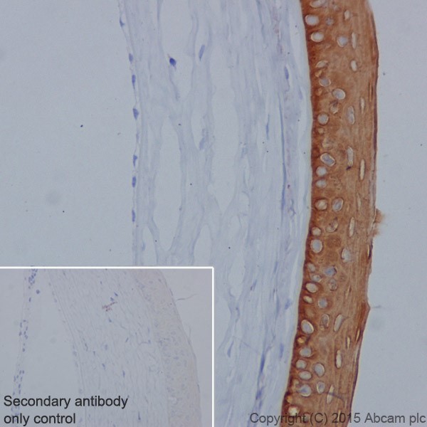 Immunohistochemistry (Formalin/PFA-fixed paraffin-embedded sections) - Anti-Keratin 12/K12 antibody [EPR17882] - BSA and Azide free (AB240295), expandable thumbnail