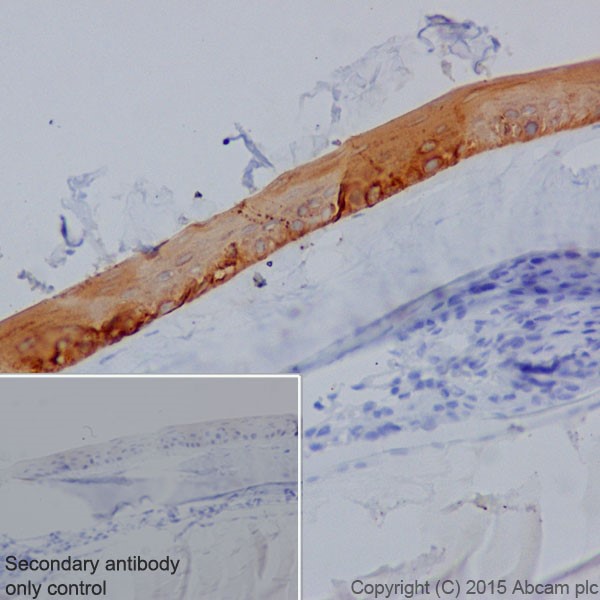 Immunohistochemistry (Formalin/PFA-fixed paraffin-embedded sections) - Anti-Keratin 12/K12 antibody [EPR17882] - BSA and Azide free (AB240295), expandable thumbnail