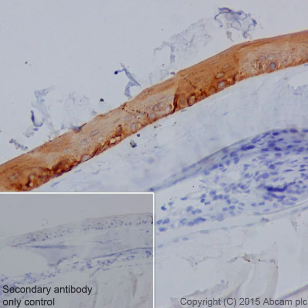 Immunohistochemistry (Formalin/PFA-fixed paraffin-embedded sections) - Anti-Keratin 12/K12 antibody [EPR17882] - BSA and Azide free (AB240295)
