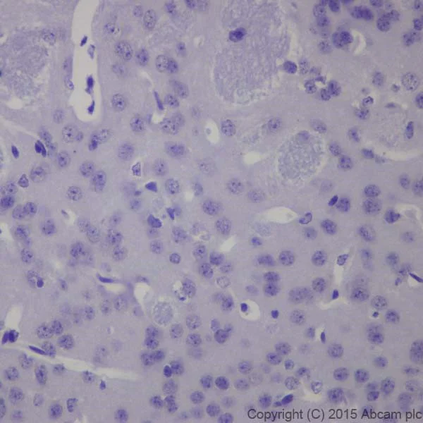 Immunohistochemistry (Formalin/PFA-fixed paraffin-embedded sections) - Anti-Keratin 12/K12 antibody [EPR17883] (AB185626)