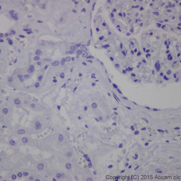 Immunohistochemistry (Formalin/PFA-fixed paraffin-embedded sections) - Anti-Keratin 12/K12 antibody [EPR17883] (AB185626)