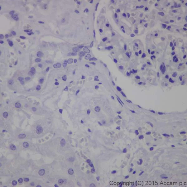 Immunohistochemistry (Formalin/PFA-fixed paraffin-embedded sections) - Anti-Keratin 12/K12 antibody [EPR17883] (AB185626)