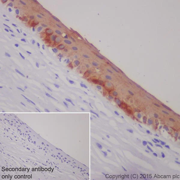 Immunohistochemistry (Formalin/PFA-fixed paraffin-embedded sections) - Anti-Keratin 12/K12 antibody [EPR17883] (AB185626)