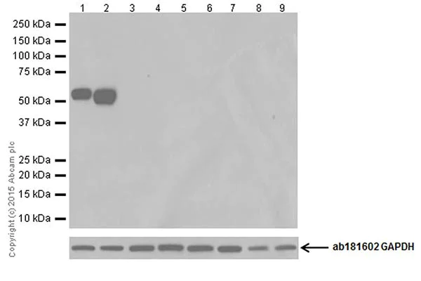 Western blot - Anti-Keratin 12/K12 antibody [EPR17883] (AB185626)