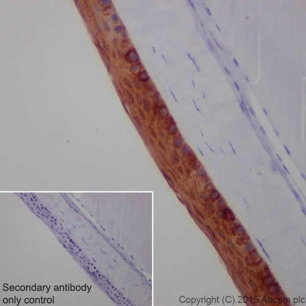 Immunohistochemistry (Formalin/PFA-fixed paraffin-embedded sections) - Anti-Keratin 12/K12 antibody [EPR17883] - BSA and Azide free (AB250843)