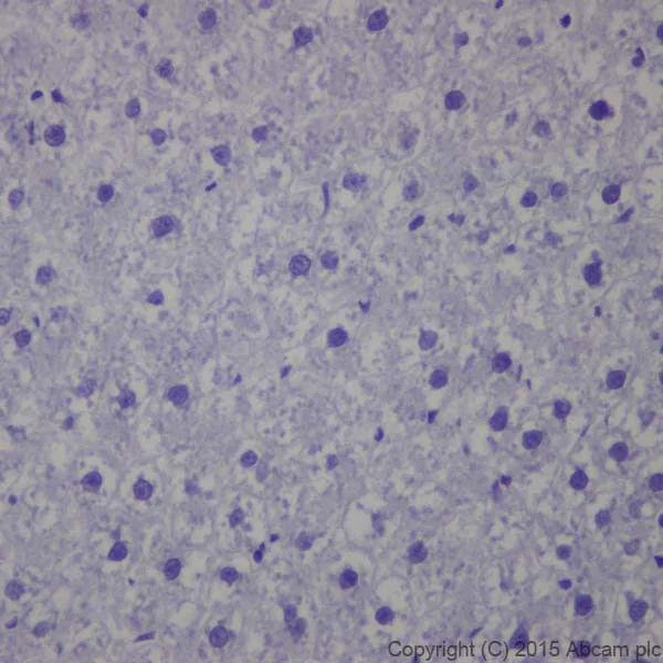 Immunohistochemistry (Formalin/PFA-fixed paraffin-embedded sections) - Anti-Keratin 12/K12 antibody [EPR17883] - BSA and Azide free (AB250843)