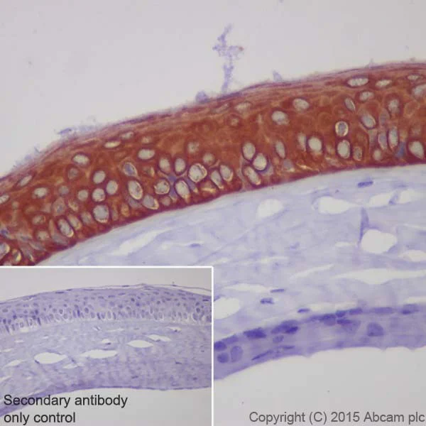 Immunohistochemistry (Formalin/PFA-fixed paraffin-embedded sections) - Anti-Keratin 12/K12 antibody [EPR17883] - BSA and Azide free (AB250843)