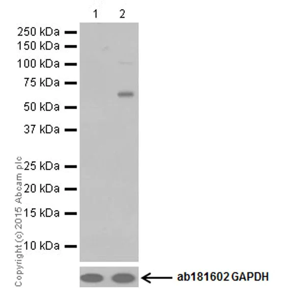 Western blot - Anti-Keratin 12/K12 antibody [EPR17883] - BSA and Azide free (AB250843)