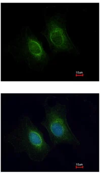 Immunocytochemistry/ Immunofluorescence - Anti-Keratin 36 antibody (AB111599)