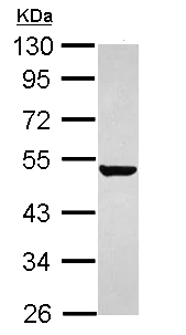 Western blot - Anti-Keratin 36 antibody (AB111599)