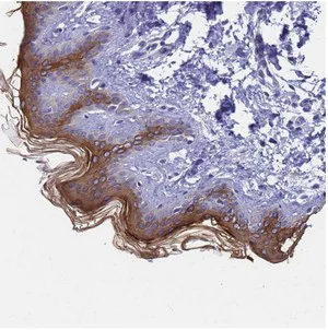 Immunohistochemistry (Formalin/PFA-fixed paraffin-embedded sections) - Anti-Keratin 77 antibody (AB126329)