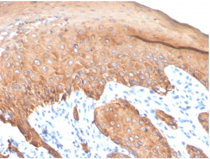 Immunohistochemistry (Formalin/PFA-fixed paraffin-embedded sections) - Anti-Keratin 77 antibody [KRTL/4440R] (AB273139)
