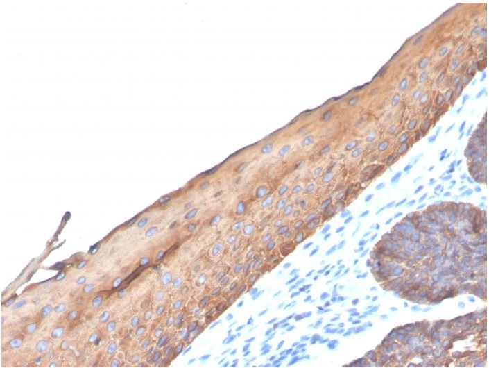 Immunohistochemistry (Formalin/PFA-fixed paraffin-embedded sections) - Anti-Keratin 77 antibody [KRTL/4440R] (AB273139)