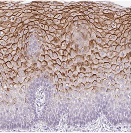 Immunohistochemistry (Formalin/PFA-fixed paraffin-embedded sections) - Anti-Keratinocyte differentiation associated protein antibody (AB204583), expandable thumbnail