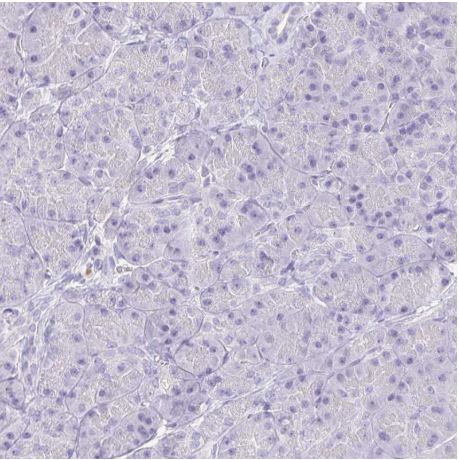 Immunohistochemistry (Formalin/PFA-fixed paraffin-embedded sections) - Anti-Keratinocyte differentiation associated protein antibody (AB204583), expandable thumbnail