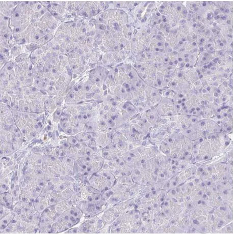 Immunohistochemistry (Formalin/PFA-fixed paraffin-embedded sections) - Anti-Keratinocyte differentiation associated protein antibody (AB204583)