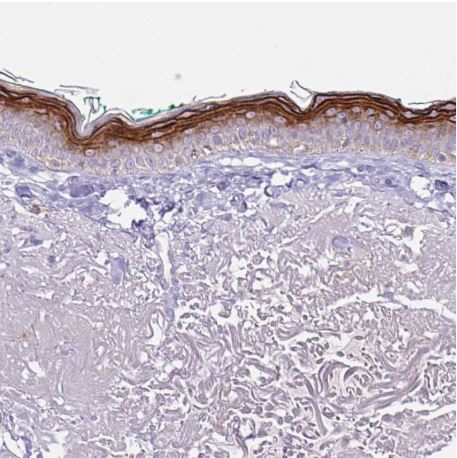 Immunohistochemistry (Formalin/PFA-fixed paraffin-embedded sections) - Anti-Keratinocyte differentiation associated protein antibody (AB204583), expandable thumbnail