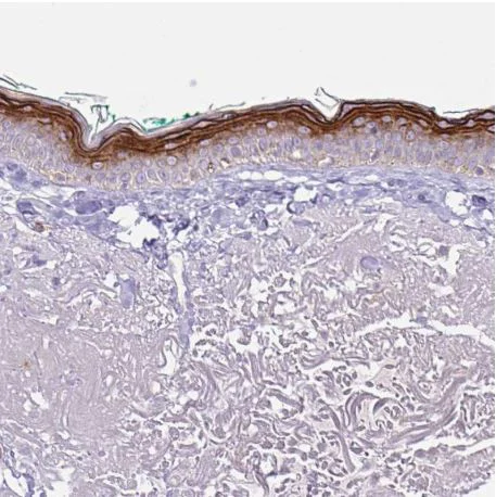 Immunohistochemistry (Formalin/PFA-fixed paraffin-embedded sections) - Anti-Keratinocyte differentiation associated protein antibody (AB204583)