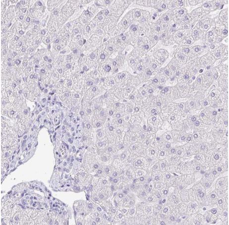 Immunohistochemistry (Formalin/PFA-fixed paraffin-embedded sections) - Anti-Keratinocyte differentiation associated protein antibody (AB204583), expandable thumbnail
