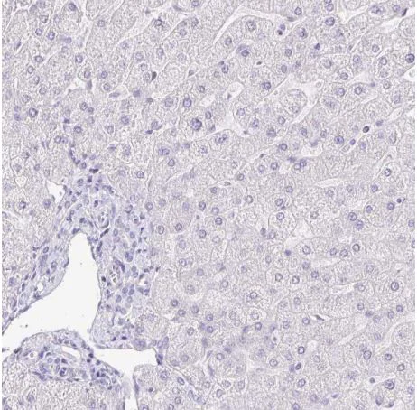 Immunohistochemistry (Formalin/PFA-fixed paraffin-embedded sections) - Anti-Keratinocyte differentiation associated protein antibody (AB204583)