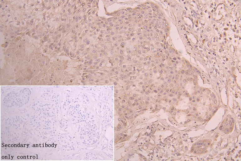 Immunohistochemistry (Formalin/PFA-fixed paraffin-embedded sections) - Anti-Keratocan/KTN antibody (AB230175)