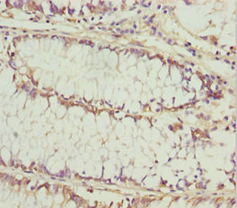 Immunohistochemistry (Formalin/PFA-fixed paraffin-embedded sections) - Anti-Keratocan/KTN antibody (AB230175)