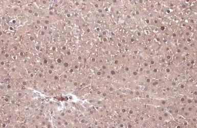 Immunohistochemistry (Formalin/PFA-fixed paraffin-embedded sections) - Anti-ketohexokinase antibody (AB154405)